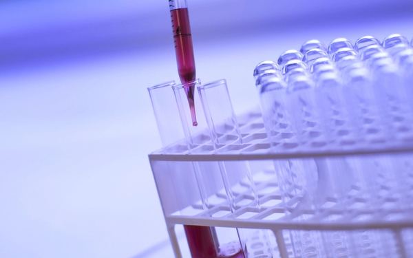 Tubos de ensayo en un laboratorio